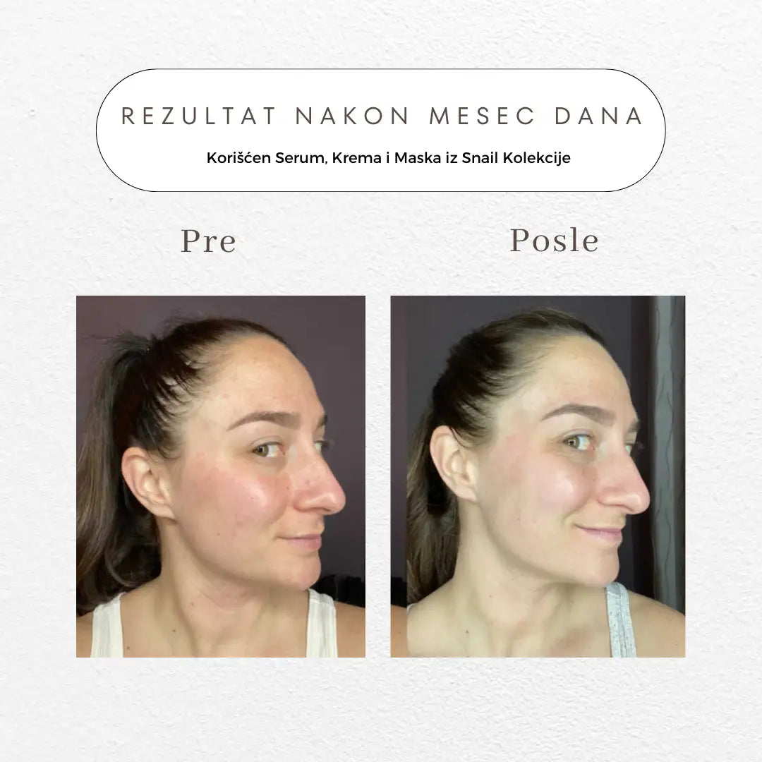 Snail Skin Concentrate Završna Maska za Lice, 50ml
