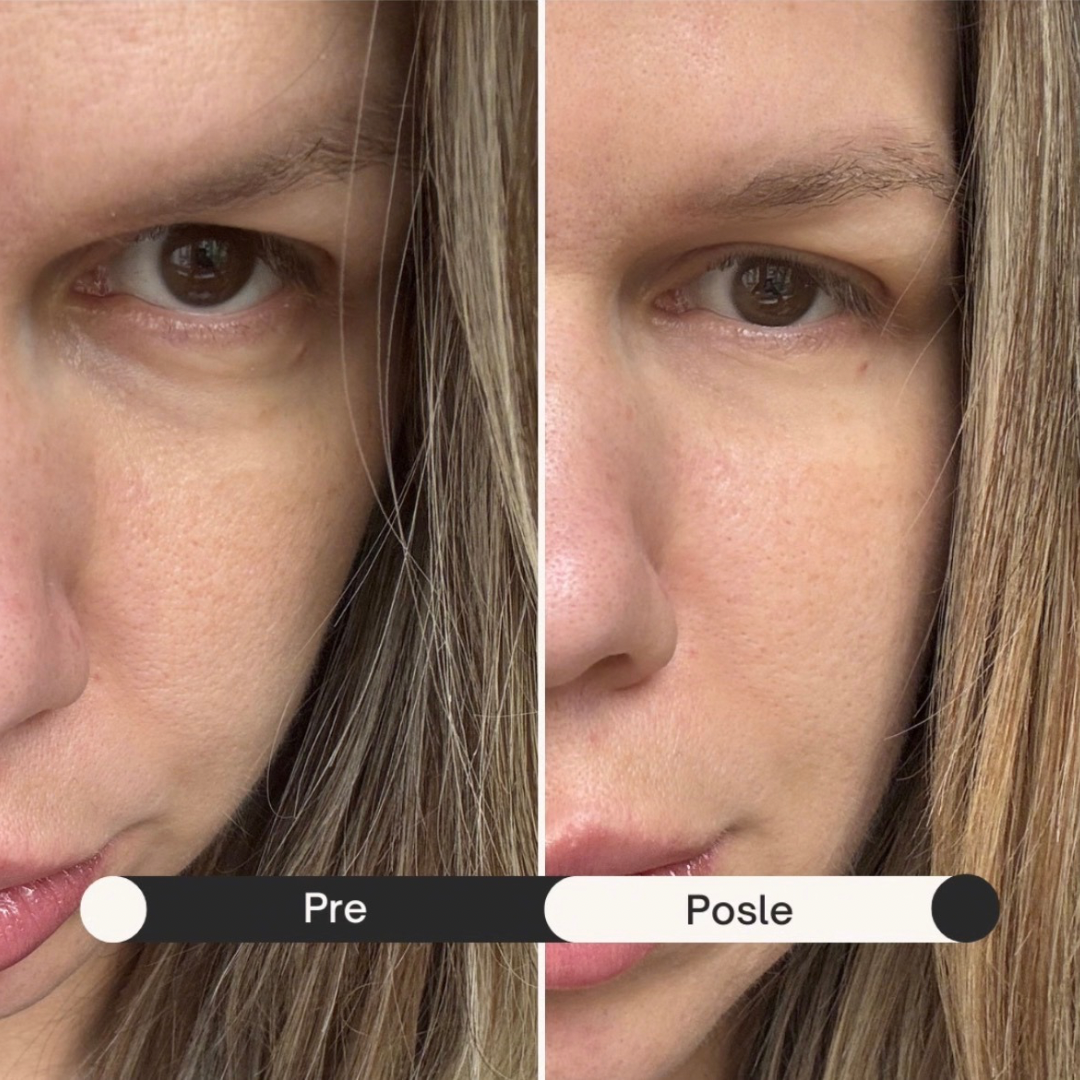 Snail Krema sa Efektom Botoksa - Uklanjanje Bora za 60 Sekundi, 18ml