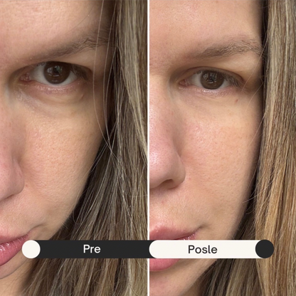 Snail Krema sa Efektom Botoksa - Uklanjanje Bora za 60 Sekundi, 18ml